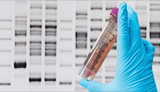 Western Blot